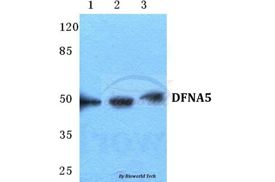 Anti-DFNA5 Antibody from Bioworld Technology (BS5697) - Antibodies.com