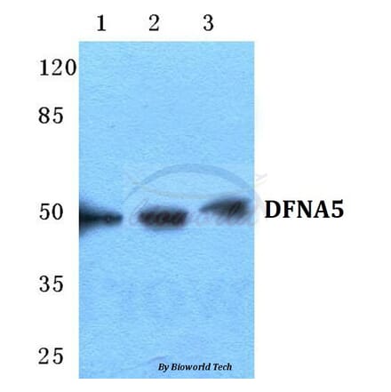Anti-DFNA5 Antibody from Bioworld Technology (BS5697) - Antibodies.com