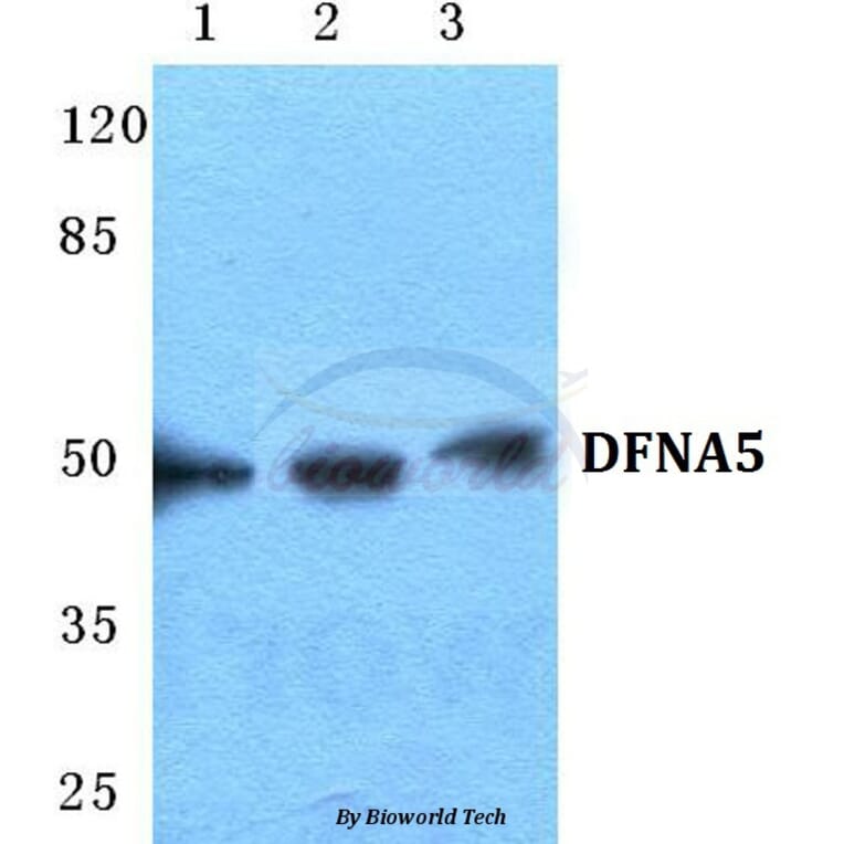 Anti-DFNA5 Antibody from Bioworld Technology (BS5697) - Antibodies.com