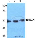 Anti-DFNA5 Antibody from Bioworld Technology (BS5697) - Antibodies.com