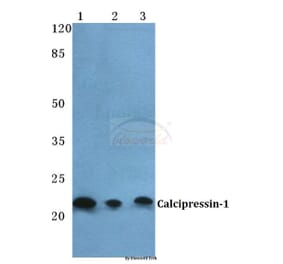 Anti-Calcipressin-1 Antibody from Bioworld Technology (BS5702) - Antibodies.com