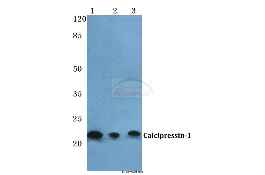 Anti-Calcipressin-1 Antibody from Bioworld Technology (BS5702) - Antibodies.com