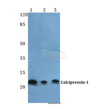 Anti-Calcipressin-1 Antibody from Bioworld Technology (BS5702) - Antibodies.com