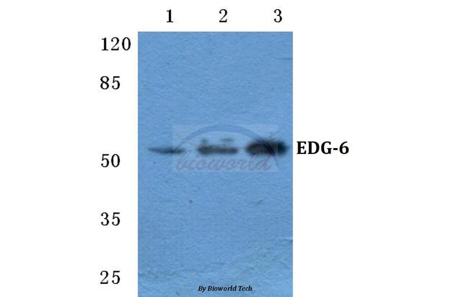 Anti-EDG-6 Antibody from Bioworld Technology (BS5706) - Antibodies.com