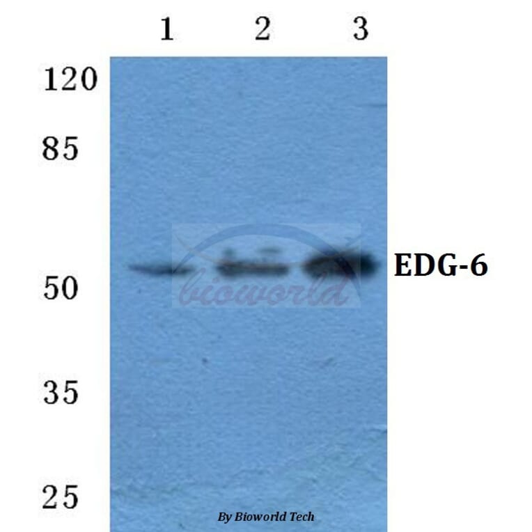 Anti-EDG-6 Antibody from Bioworld Technology (BS5706) - Antibodies.com