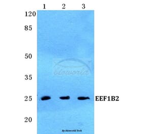 Anti-EEF1B2 Antibody from Bioworld Technology (BS5708) - Antibodies.com