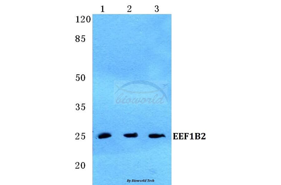 Anti-EEF1B2 Antibody from Bioworld Technology (BS5708) - Antibodies.com