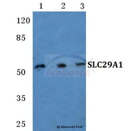 Anti-SLC29A1 Antibody from Bioworld Technology (BS5712) - Antibodies.com