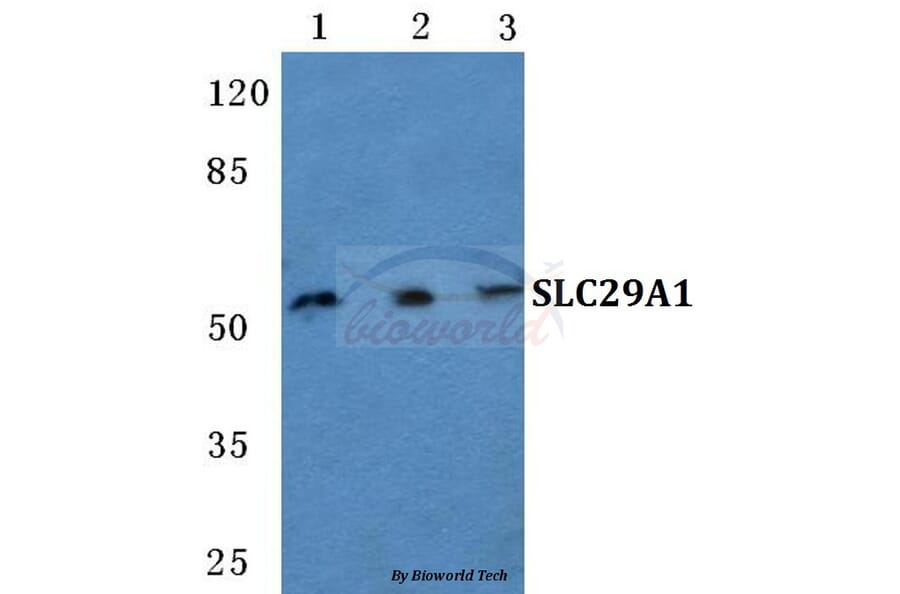 Anti-SLC29A1 Antibody from Bioworld Technology (BS5712) - Antibodies.com