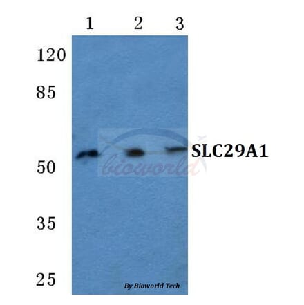 Anti-SLC29A1 Antibody from Bioworld Technology (BS5712) - Antibodies.com