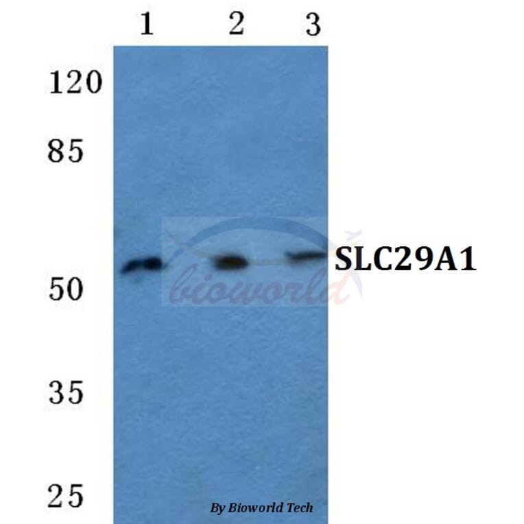 Anti-SLC29A1 Antibody from Bioworld Technology (BS5712) - Antibodies.com