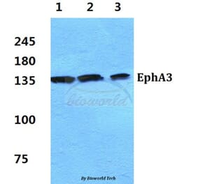 Anti-EphA3 Antibody from Bioworld Technology (BS5714) - Antibodies.com