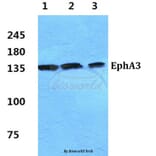 Anti-EphA3 Antibody from Bioworld Technology (BS5714) - Antibodies.com