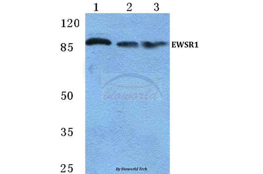 Anti-EWSR1 Antibody from Bioworld Technology (BS5715) - Antibodies.com
