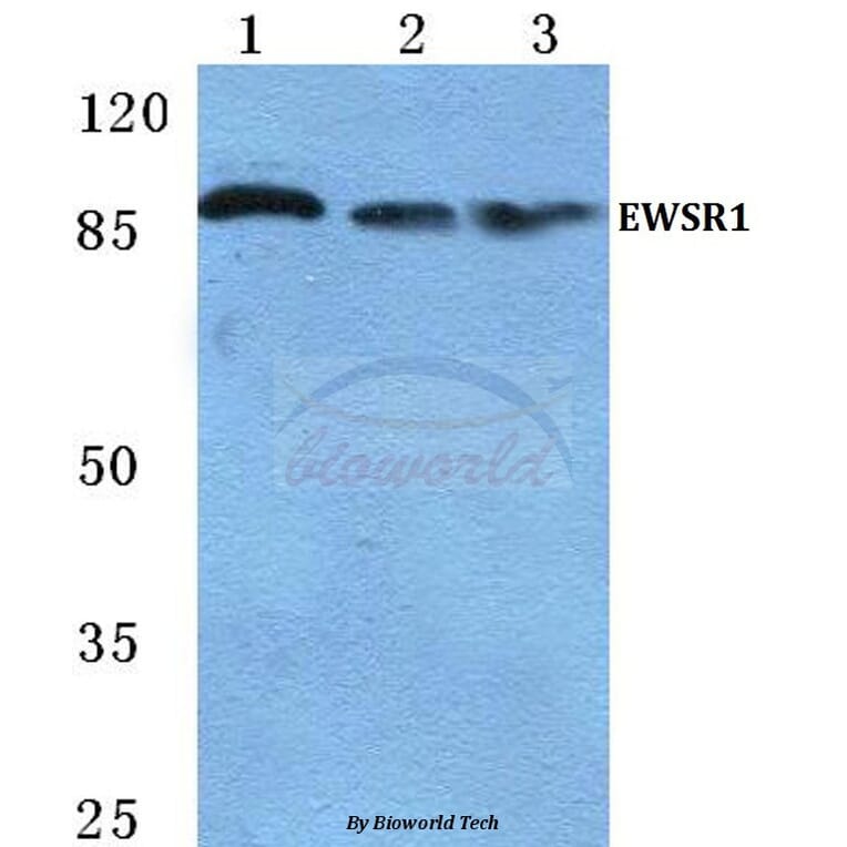 Anti-EWSR1 Antibody from Bioworld Technology (BS5715) - Antibodies.com