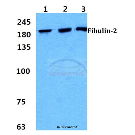 Anti-Fibulin-2 Antibody from Bioworld Technology (BS5718) - Antibodies.com