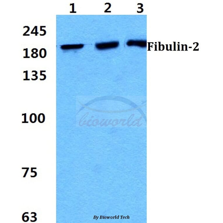 Anti-Fibulin-2 Antibody from Bioworld Technology (BS5718) - Antibodies.com