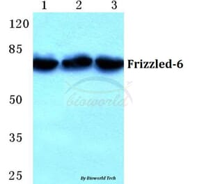 Anti-Frizzled-6 (G169) Antibody from Bioworld Technology (BS5721) - Antibodies.com