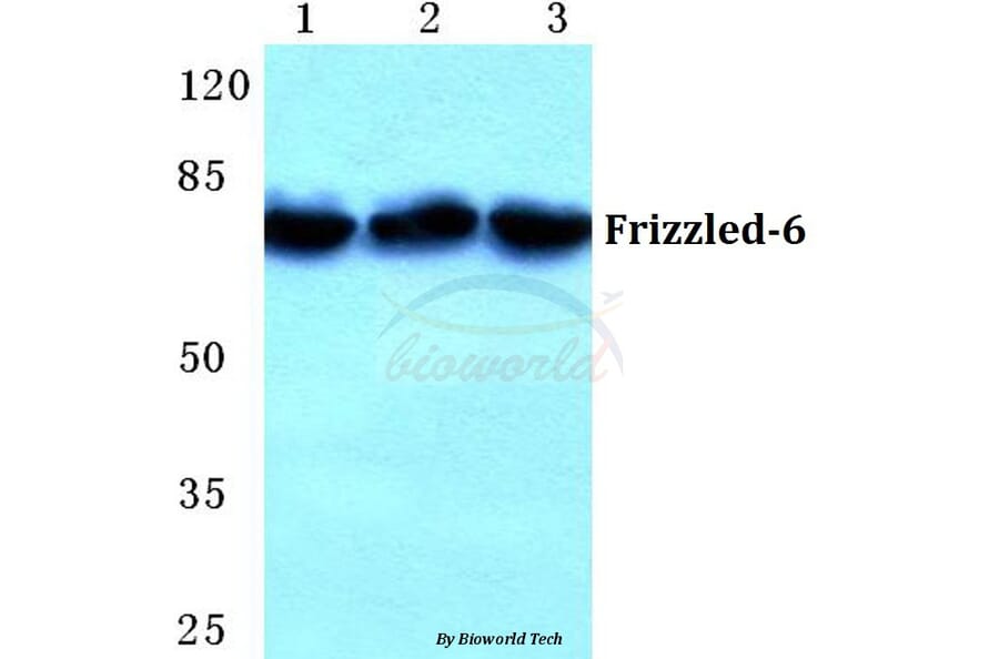 Anti-Frizzled-6 (G169) Antibody from Bioworld Technology (BS5721) - Antibodies.com