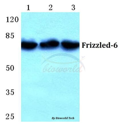 Anti-Frizzled-6 (G169) Antibody from Bioworld Technology (BS5721) - Antibodies.com