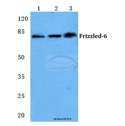 Anti-Frizzled-6 (T167) Antibody from Bioworld Technology (BS5722) - Antibodies.com