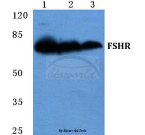 Anti-FSHR Antibody from Bioworld Technology (BS5724) - Antibodies.com