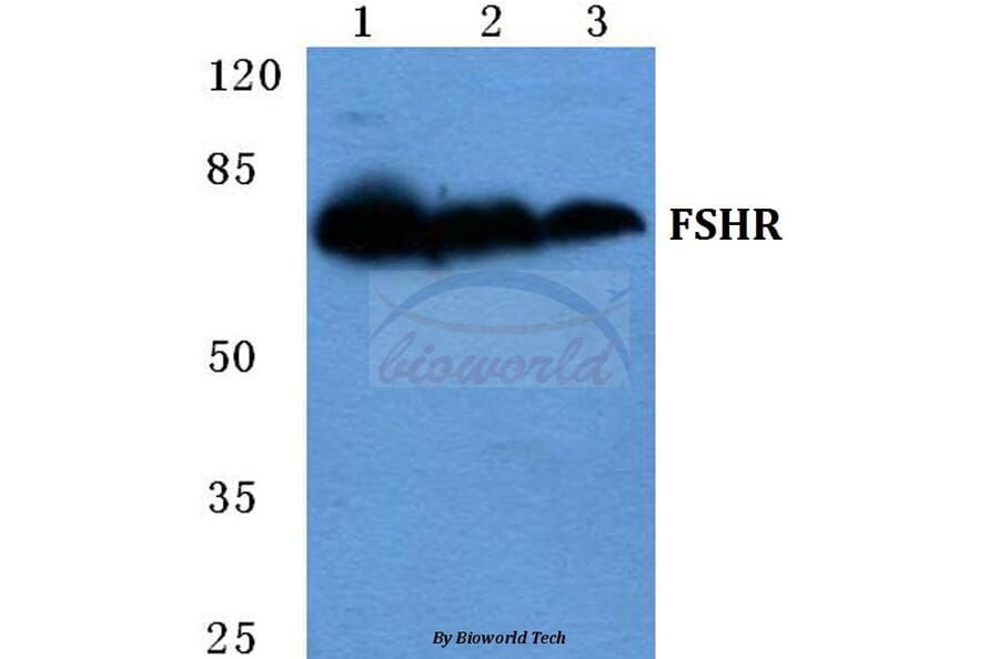 Anti-FSHR Antibody from Bioworld Technology (BS5724) - Antibodies.com