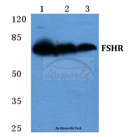 Anti-FSHR Antibody from Bioworld Technology (BS5724) - Antibodies.com