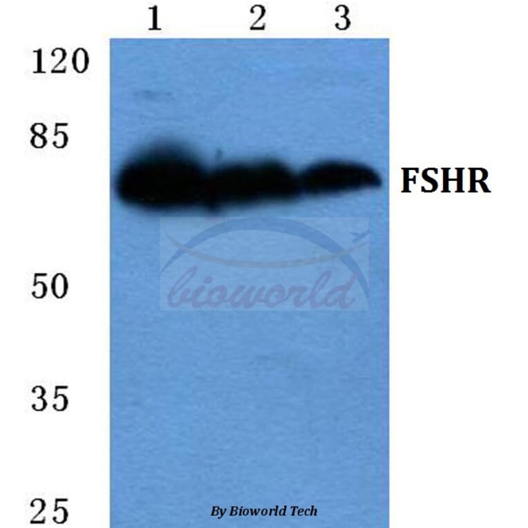 Anti-FSHR Antibody from Bioworld Technology (BS5724) - Antibodies.com