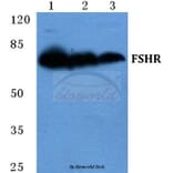 Anti-FSHR Antibody from Bioworld Technology (BS5724) - Antibodies.com