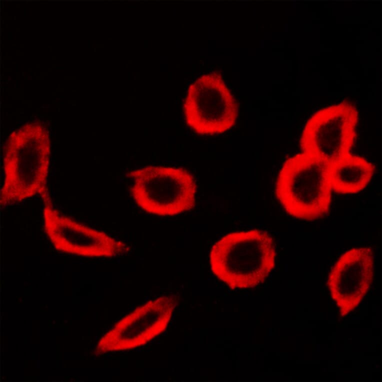 Anti-FSHR Antibody from Bioworld Technology (BS5724) - Antibodies.com