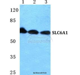 Anti-SLC6A1 Antibody from Bioworld Technology (BS5726) - Antibodies.com