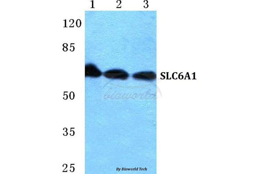 Anti-SLC6A1 Antibody from Bioworld Technology (BS5726) - Antibodies.com