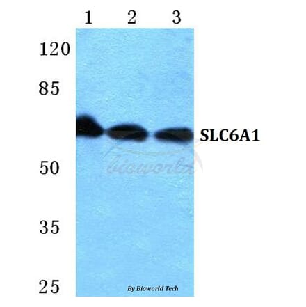 Anti-SLC6A1 Antibody from Bioworld Technology (BS5726) - Antibodies.com