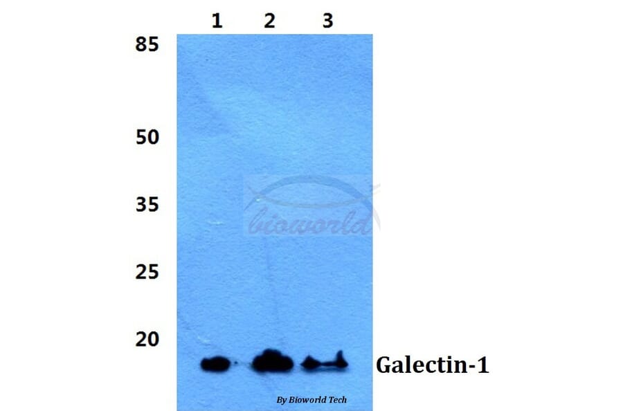 Anti-Galectin-1 Antibody from Bioworld Technology (BS5728) - Antibodies.com