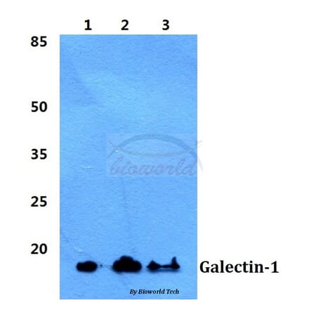 Anti-Galectin-1 Antibody from Bioworld Technology (BS5728) - Antibodies.com