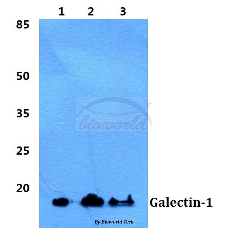 Anti-Galectin-1 Antibody from Bioworld Technology (BS5728) - Antibodies.com
