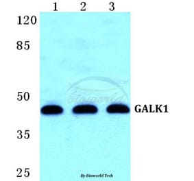 Anti-GALK1 Antibody from Bioworld Technology (BS5729) - Antibodies.com