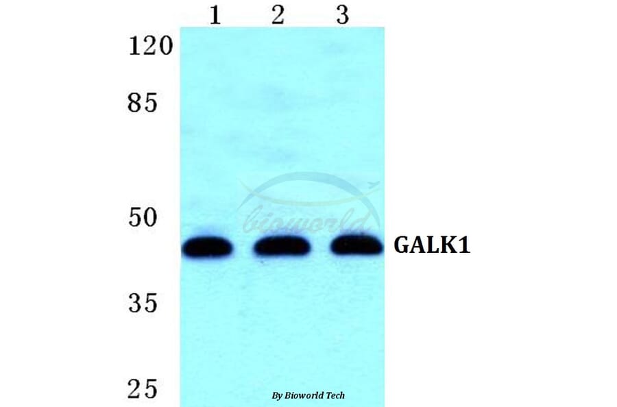 Anti-GALK1 Antibody from Bioworld Technology (BS5729) - Antibodies.com