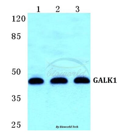 Anti-GALK1 Antibody from Bioworld Technology (BS5729) - Antibodies.com