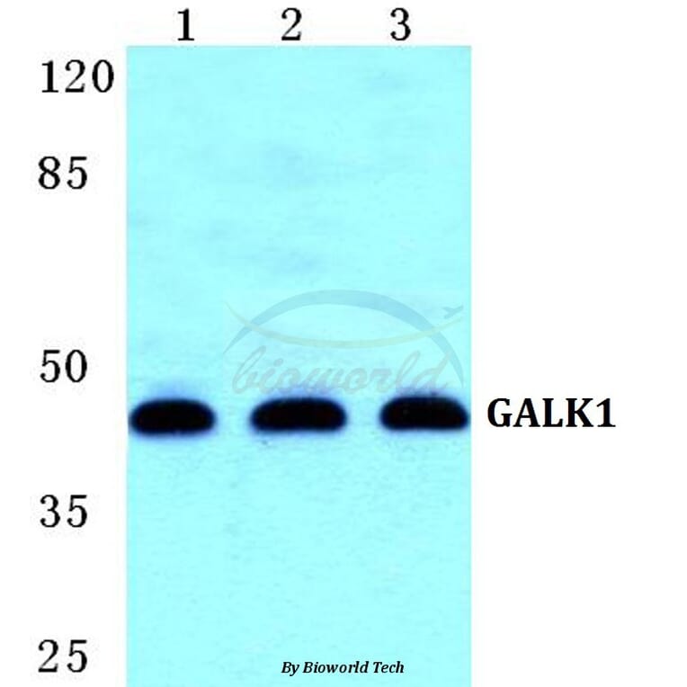 Anti-GALK1 Antibody from Bioworld Technology (BS5729) - Antibodies.com