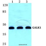 Anti-GALK1 Antibody from Bioworld Technology (BS5729) - Antibodies.com