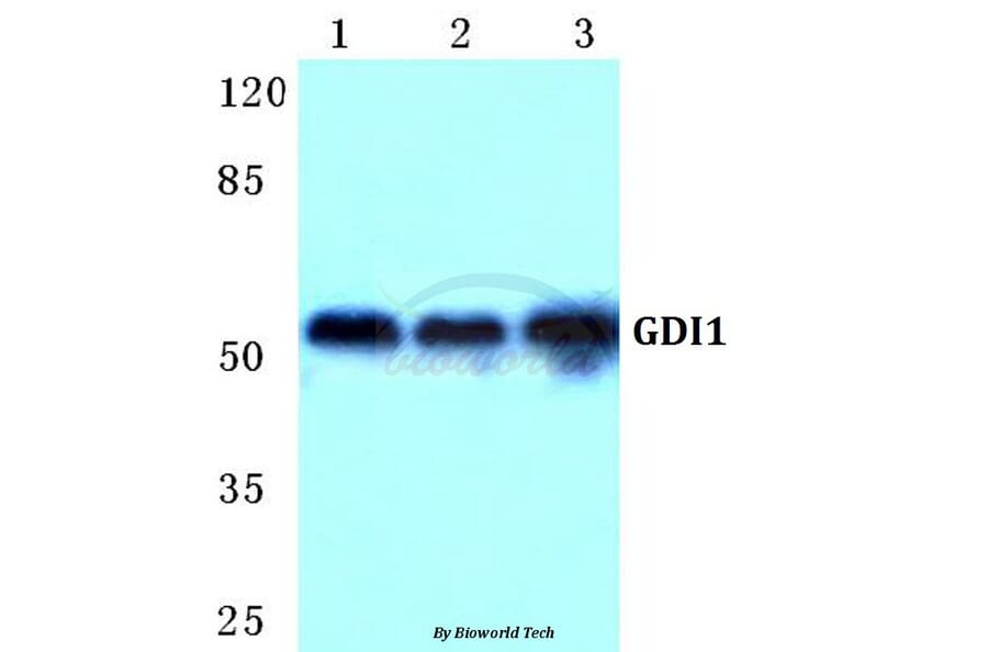 Anti-GDI1 Antibody from Bioworld Technology (BS5731) - Antibodies.com