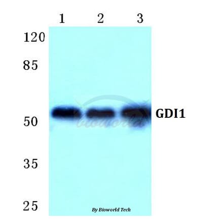 Anti-GDI1 Antibody from Bioworld Technology (BS5731) - Antibodies.com
