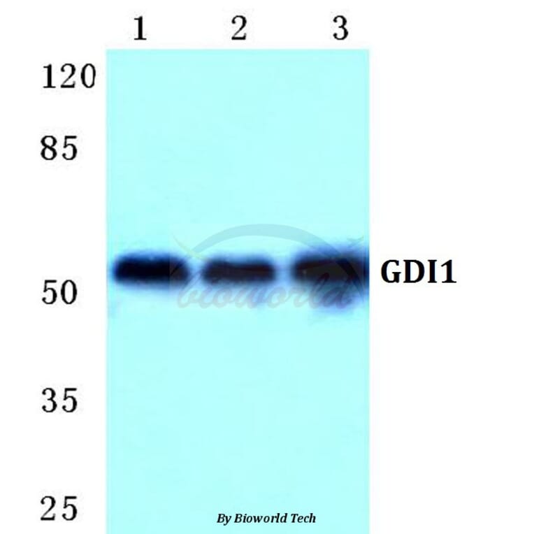 Anti-GDI1 Antibody from Bioworld Technology (BS5731) - Antibodies.com