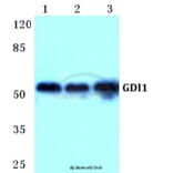 Anti-GDI1 Antibody from Bioworld Technology (BS5731) - Antibodies.com