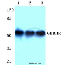 Anti-GHRHR Antibody from Bioworld Technology (BS5732) - Antibodies.com