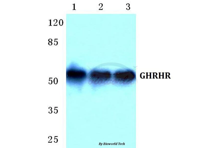 Anti-GHRHR Antibody from Bioworld Technology (BS5732) - Antibodies.com