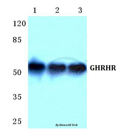 Anti-GHRHR Antibody from Bioworld Technology (BS5732) - Antibodies.com