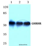 Anti-GHRHR Antibody from Bioworld Technology (BS5732) - Antibodies.com